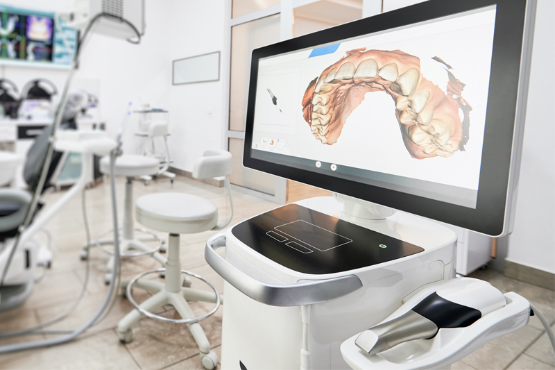 Intra-Oral Scanner in Columbus